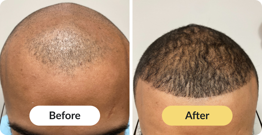 Frame 1484579454 (2)