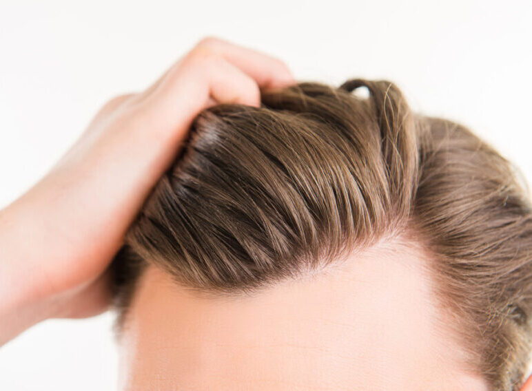 Remove The Hair Follicles